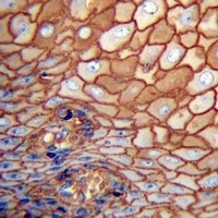 CD44 Mouse Monoclonal Antibody