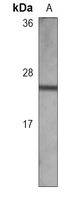 TIMP2 Mouse Monoclonal Antibody