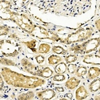 TIMP2 Mouse Monoclonal Antibody