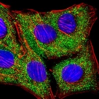 TIMP2 Mouse Monoclonal Antibody
