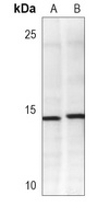 FABP4 Mouse Monoclonal Antibody