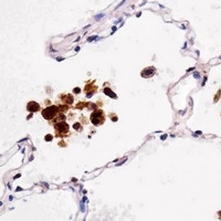 FABP4 Mouse Monoclonal Antibody