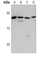 MMP9 Mouse Monoclonal Antibody