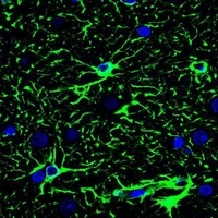 GFAP Mouse Monoclonal Antibody