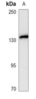 CD56 Mouse Monoclonal Antibody