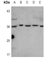 PCNA Mouse Monoclonal Antibody