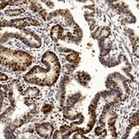 PCNA Mouse Monoclonal Antibody