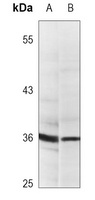 PCNA Mouse Monoclonal Antibody