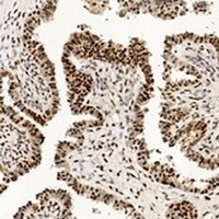 PCNA Mouse Monoclonal Antibody