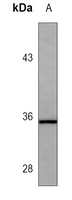 CD20 Mouse Monoclonal Antibody