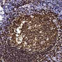 CD20 Mouse Monoclonal Antibody