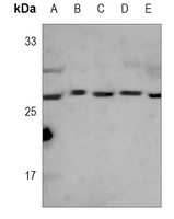 CDK4 Mouse Monoclonal Antibody