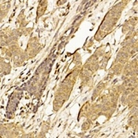 CDK4 Mouse Monoclonal Antibody