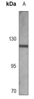 FGFR1 Mouse Monoclonal Antibody