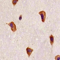 FGFR1 Mouse Monoclonal Antibody
