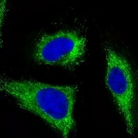 FGFR1 Mouse Monoclonal Antibody