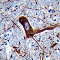 MAP2 Mouse Monoclonal Antibody