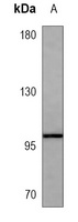 CD117 Mouse Monoclonal Antibody