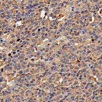 CD117 Mouse Monoclonal Antibody