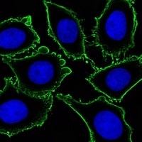 CD117 Mouse Monoclonal Antibody