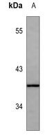 SPARC Mouse Monoclonal Antibody