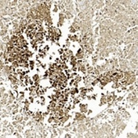 Gamma-enolase Mouse Monoclonal Antibody
