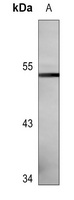 Cytochrome P450 3A4 Mouse Monoclonal Antibody