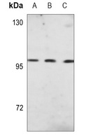 CD10 Mouse Monoclonal Antibody