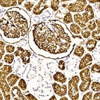 CD10 Mouse Monoclonal Antibody