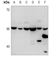 Beta5-tubulin Mouse Monoclonal Antibody