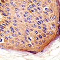CD115 Mouse Monoclonal Antibody