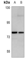 c-FER Mouse Monoclonal Antibody