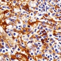 FYN Mouse Monoclonal Antibody