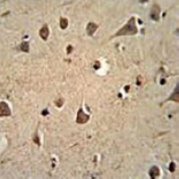 ALDH2 Mouse Monoclonal Antibody