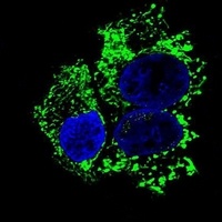 ALDH2 Mouse Monoclonal Antibody