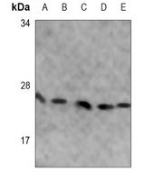 SOD2 Mouse Monoclonal Antibody