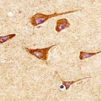 SOD2 Mouse Monoclonal Antibody