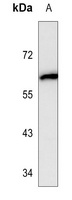 ALB Mouse Monoclonal Antibody