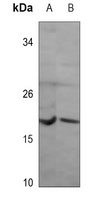 NRAS Mouse Monoclonal Antibody