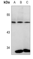 PGK1 Mouse Monoclonal Antibody
