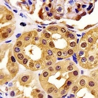 PGK1 Mouse Monoclonal Antibody