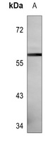 CNOT4 Mouse Monoclonal Antibody