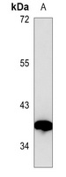 VEGFD Mouse Monoclonal Antibody