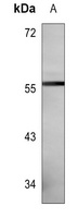 CYP27B1 Mouse Monoclonal Antibody
