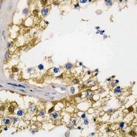 Pyridoxal Kinase Mouse Monoclonal Antibody