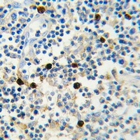 Lambda light chain Mouse Monoclonal Antibody