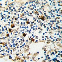 Kappa light chain Mouse Monoclonal Antibody