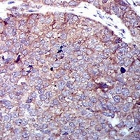 GLUT4 Mouse Monoclonal Antibody