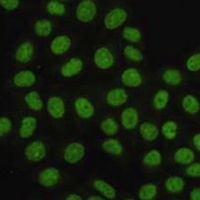 PCNA Mouse Monoclonal Antibody