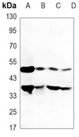 DR5 Mouse Monoclonal Antibody